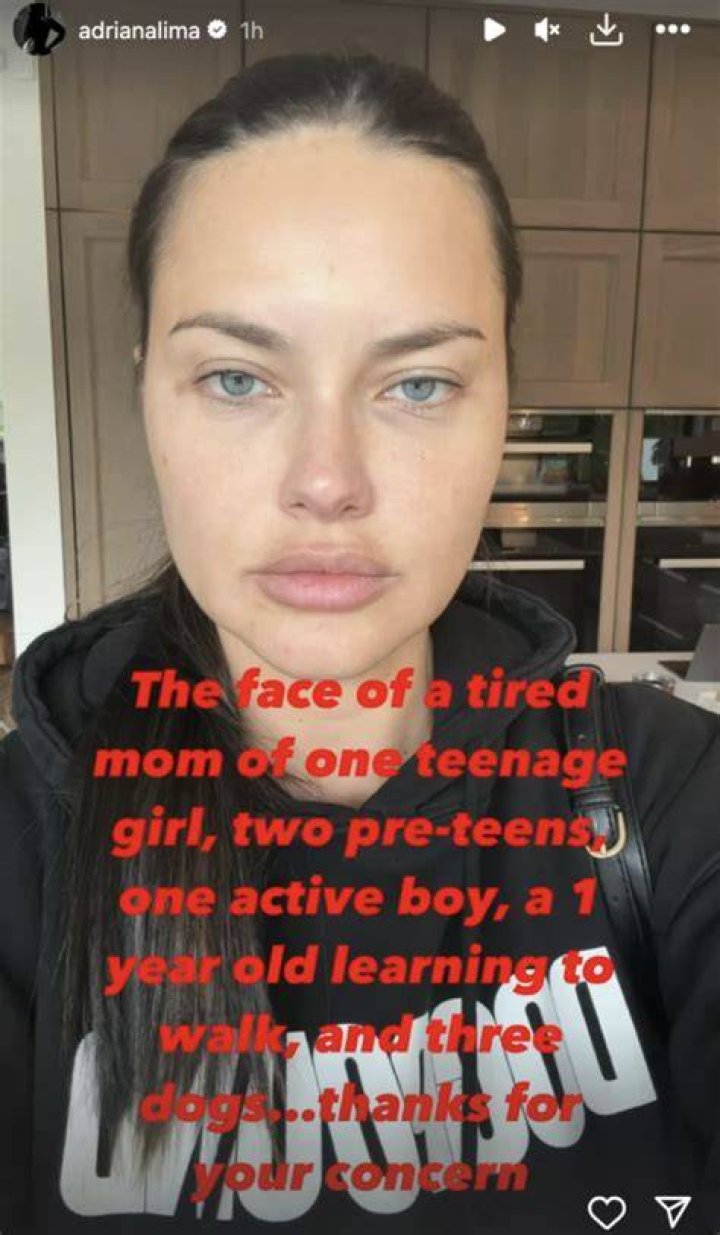 Adriana Lima Fat: Unveiling the Truth Behind the Headlines