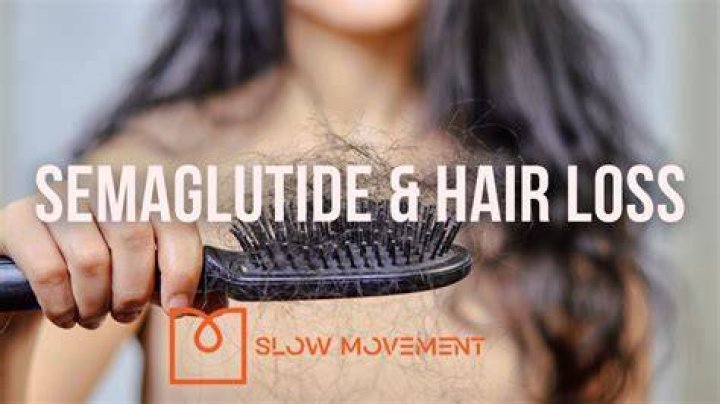 Can Semaglutide Cause Hair Loss? Exploring the Facts and Myths