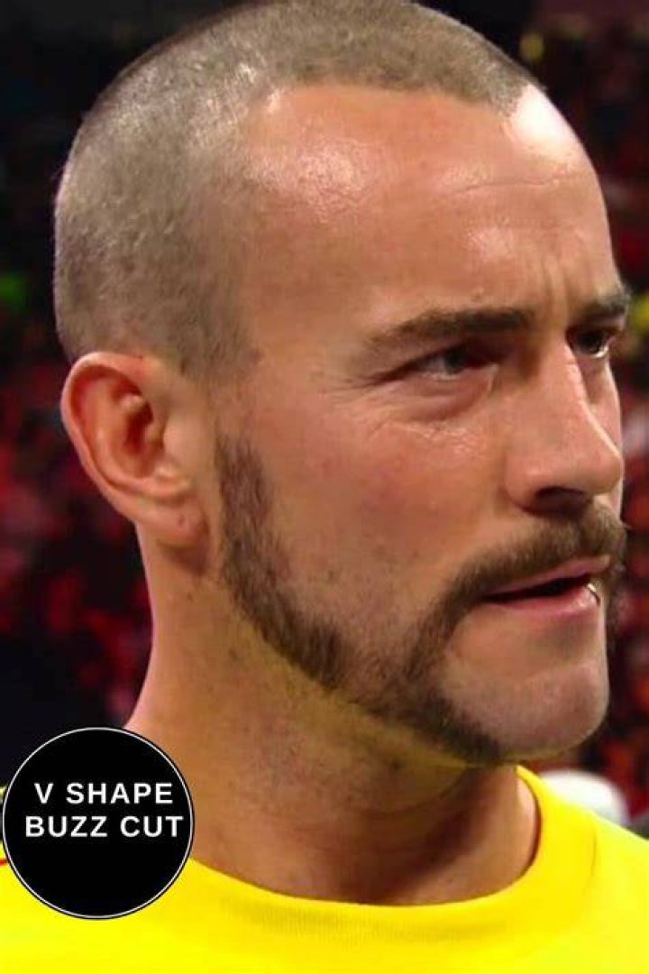 CM Punk Hair Plugs: The Ultimate Guide to Understanding Hair Restoration