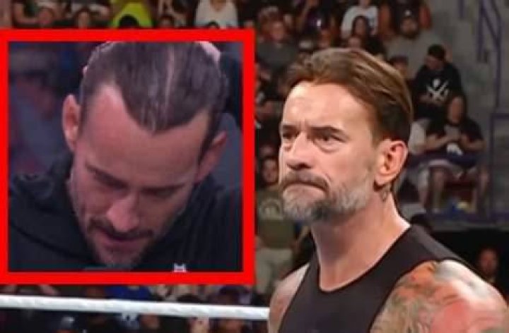 CM Punk Hair Transplant: The Ultimate Guide to Restoring Your Confidence