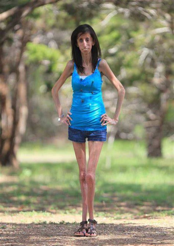 Discovering the Skinniest Girl in the World: A Journey into Uniqueness
