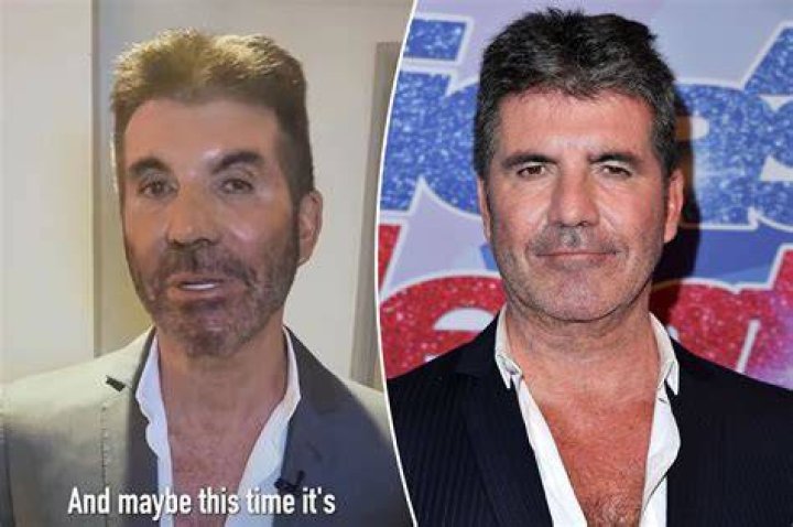 Is Simon Cowell Alive? Oread Update
