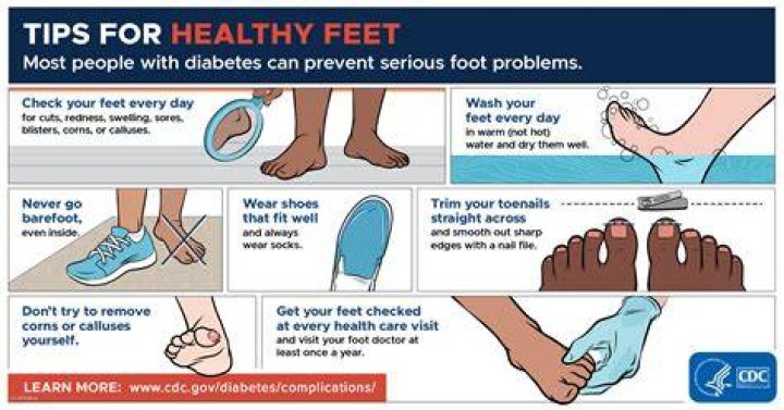 Kiffa Feet: The Ultimate Guide to Understanding and Managing Foot Health