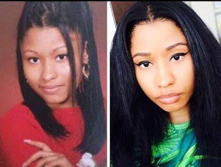 Nicki Before Plastic Surgery: Unveiling the Journey to Fame and Transformation