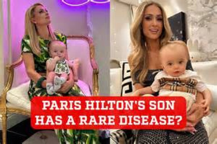 Paris Hilton Baby Disease: Understanding, Symptoms, Diagnosis, and Treatment